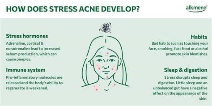 Are blind pimples caused by stress?