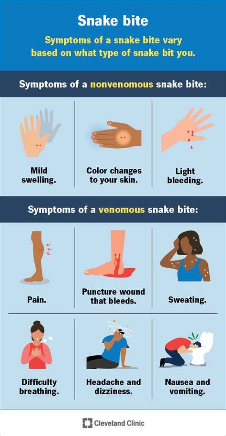 Are snake bites painful?