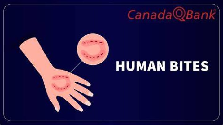 Can a human bite through bone?
