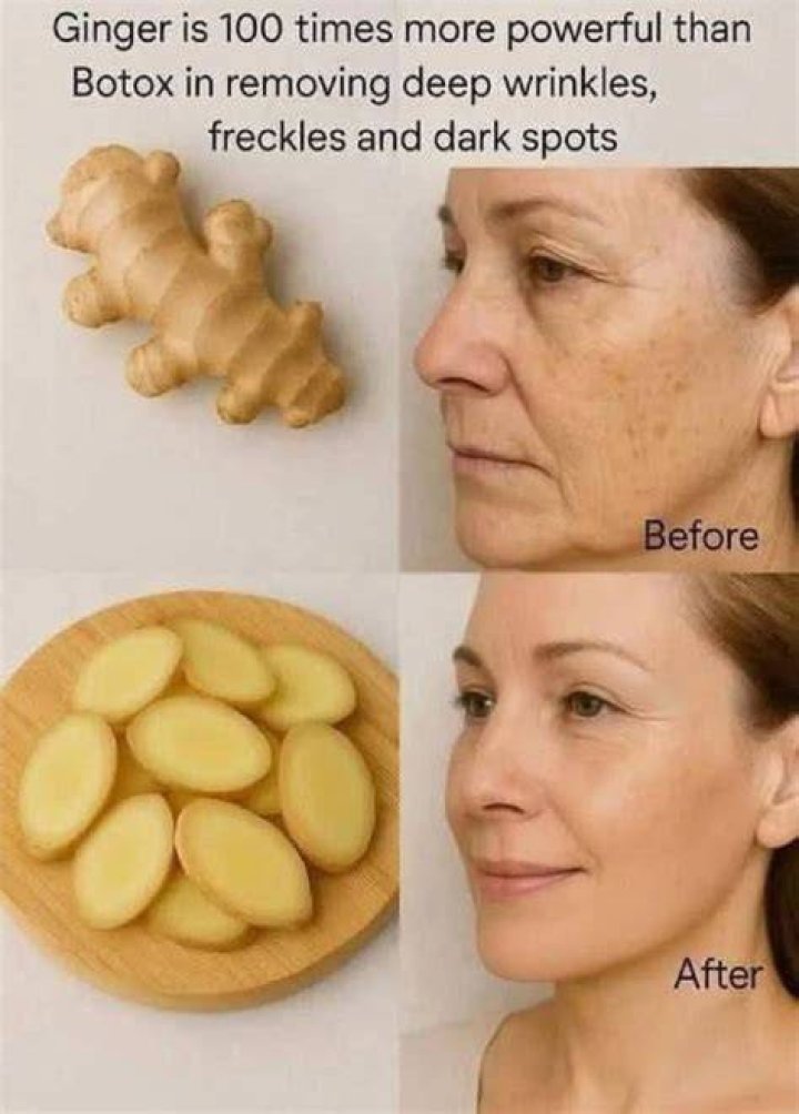 Can ginger clear dark spots?