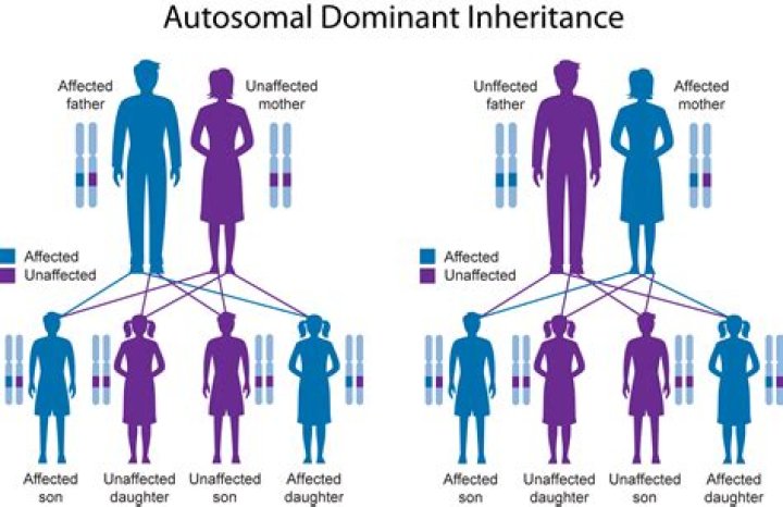 Can I inherit from my uncle?