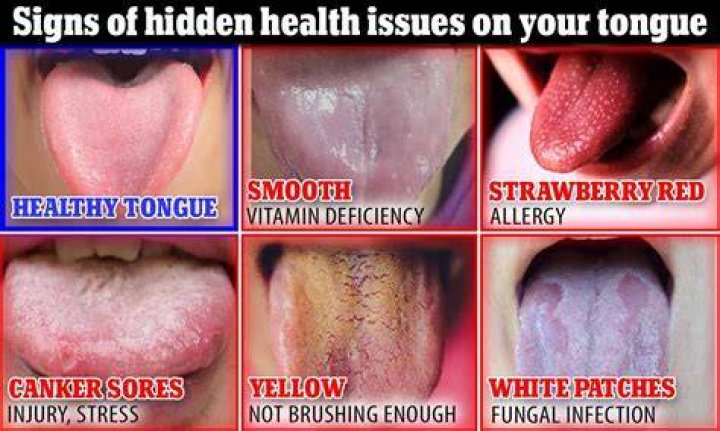 Can I make my tongue smaller?