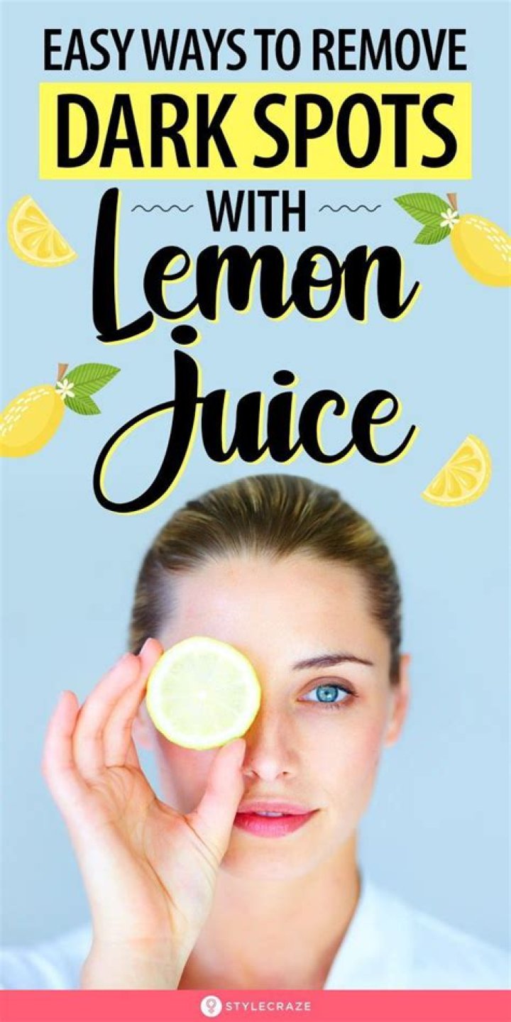 Can lemon remove dark circles?