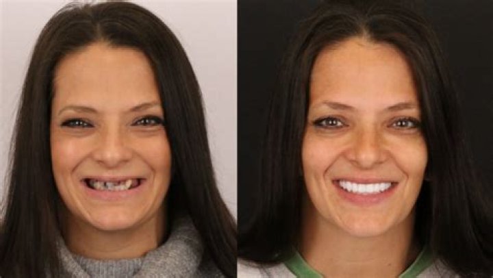 Can teeth change your face?