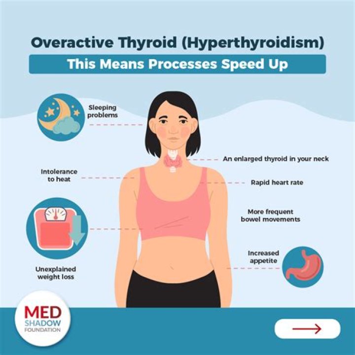 Can thyroid cause big stomach?