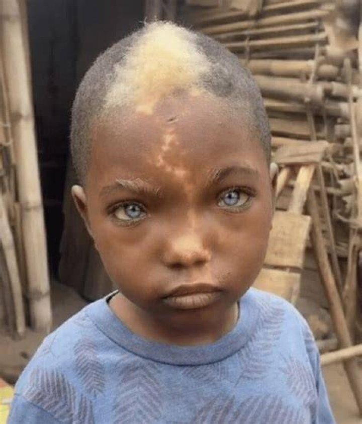 Can you be born with colored hair?