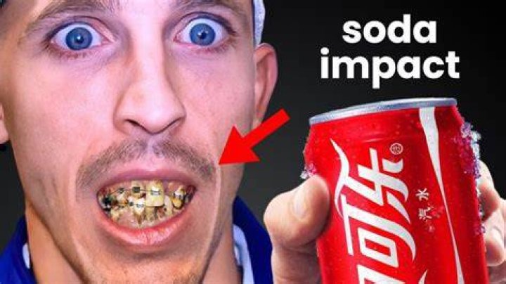 Can you drink soda while wearing a retainer?