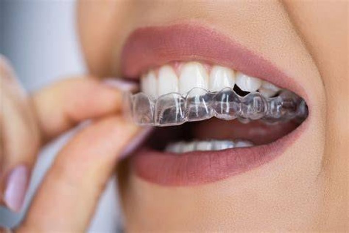 Can you drink with a retainer in?