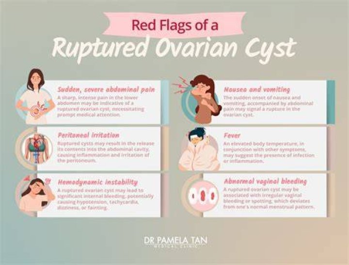Can you feel a cyst in your stomach?