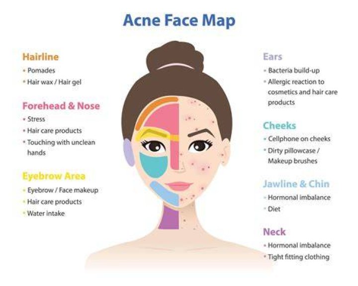 Can you get acne from massage?