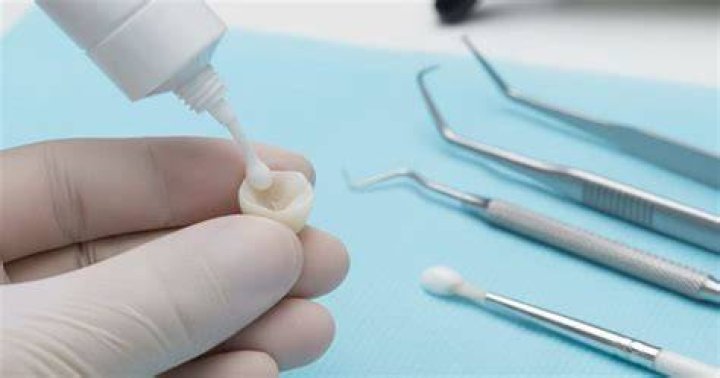 Can you glue a tooth back in?