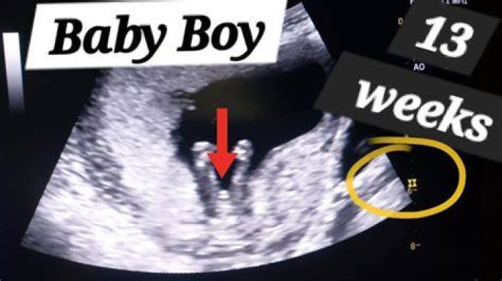Can you sue a baby?