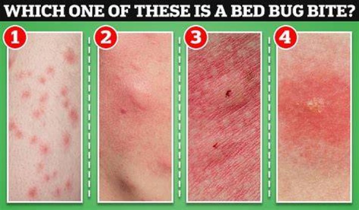 Do bed bugs ever bite just once?