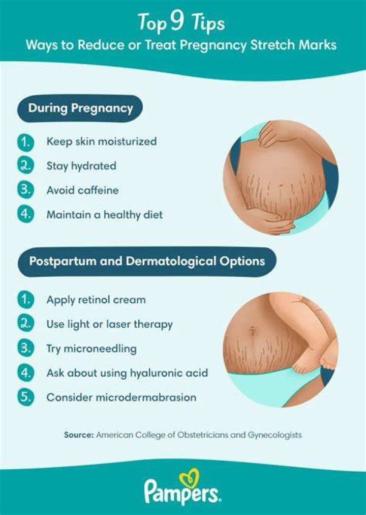 Do celebrities get pregnancy stretch marks?