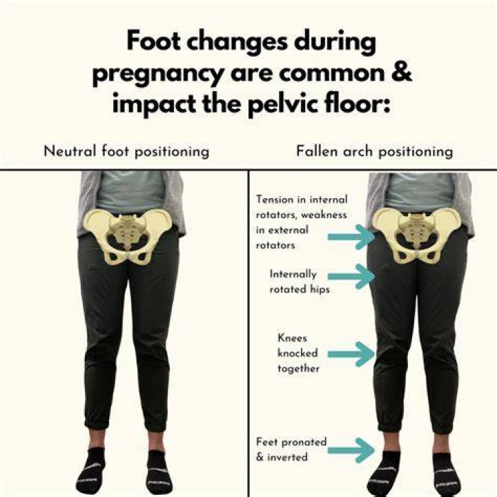 Do hips get wider after each pregnancy?