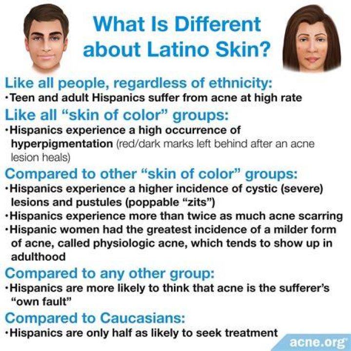 Do Hispanics get more acne?