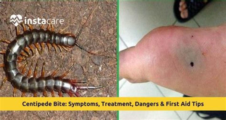 Do house centipedes bite hurt?