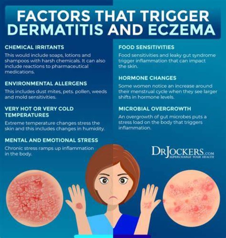 Do tomatoes make eczema worse?