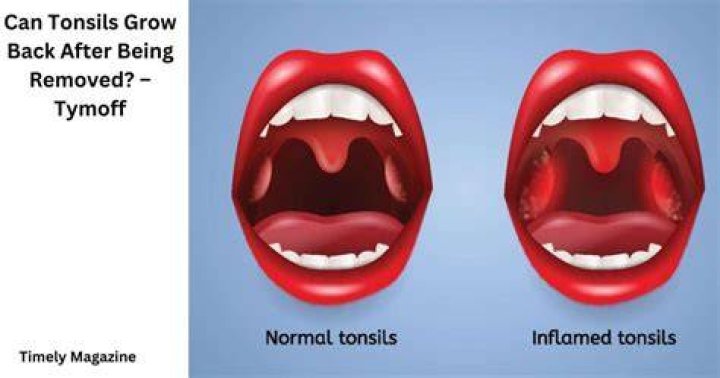 Do tonsils grow back?