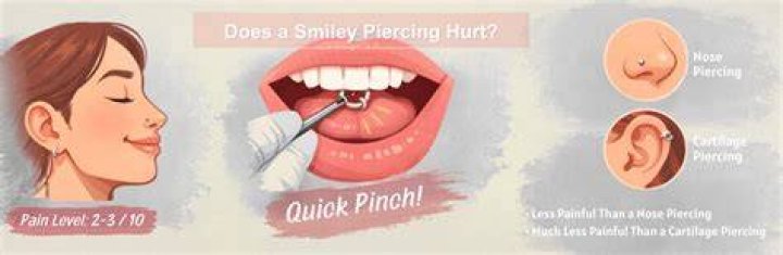 Does a smiley piercing hurt?