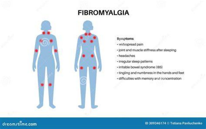 Does fibromyalgia show up on xray?