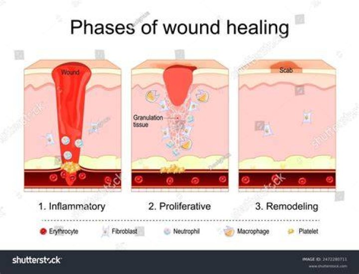 Does heat speed up wound healing?