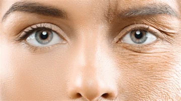 Does Irish skin age faster?