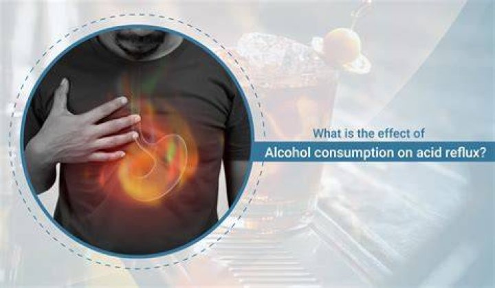 Does liquor cause acid reflux?