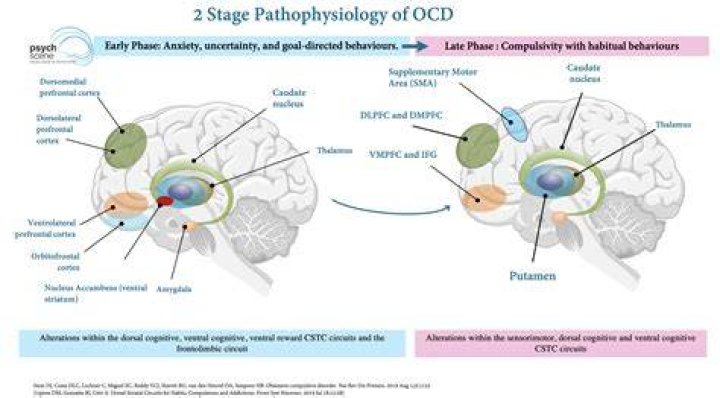 Does OCD affect your memory?