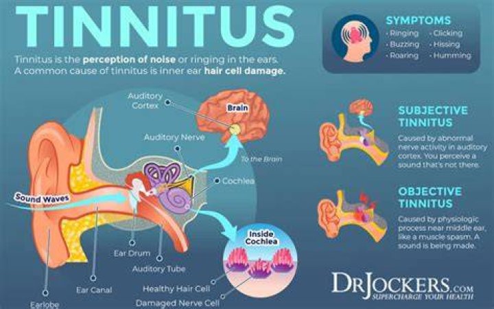Does silence help tinnitus?