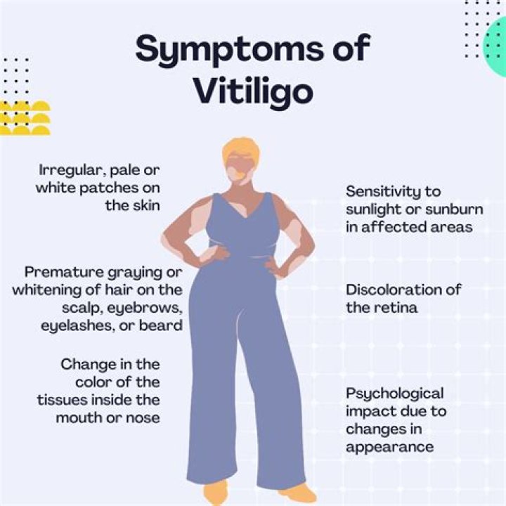 Does vitiligo cause mental illness?
