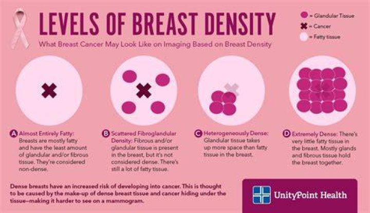 Does weight gain increase breast density?