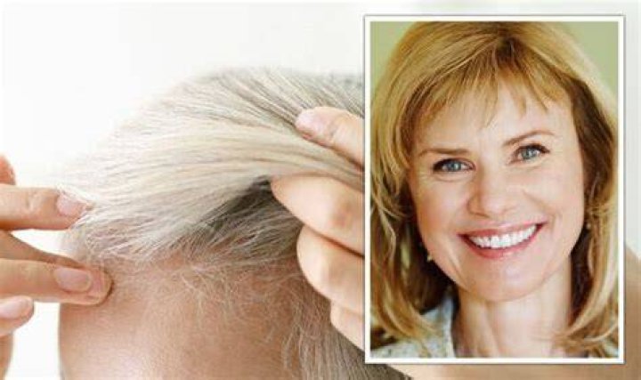 Does women's hair thin as they age?