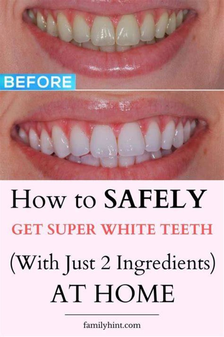 How can I get my brown teeth white again?