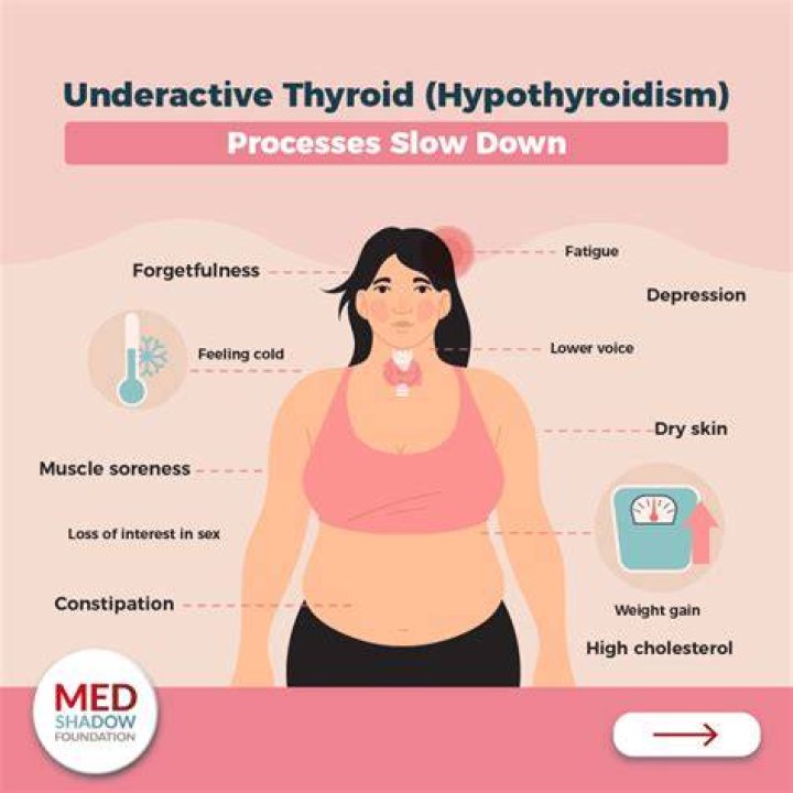 How can I lose my hypothyroid belly?
