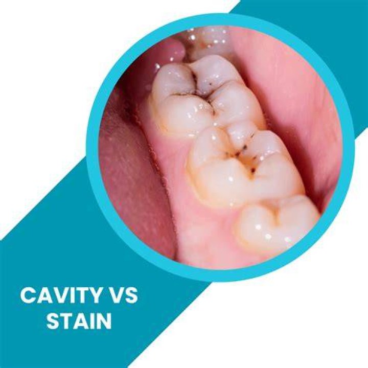 How can you tell its a stain?