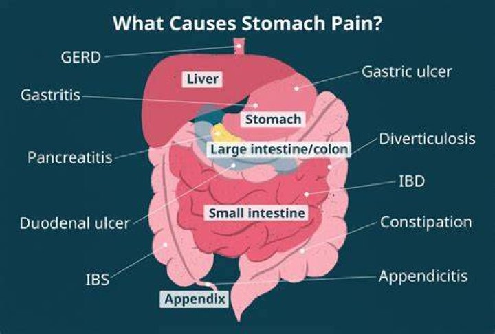 How do I know if my upper stomach pain is serious?