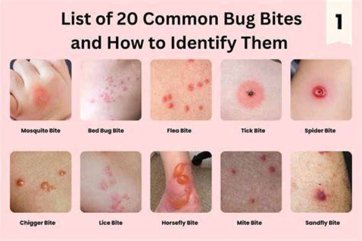 How do I know what bug bit me?