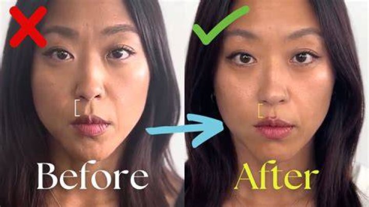 How do I make my philtrum look smaller?
