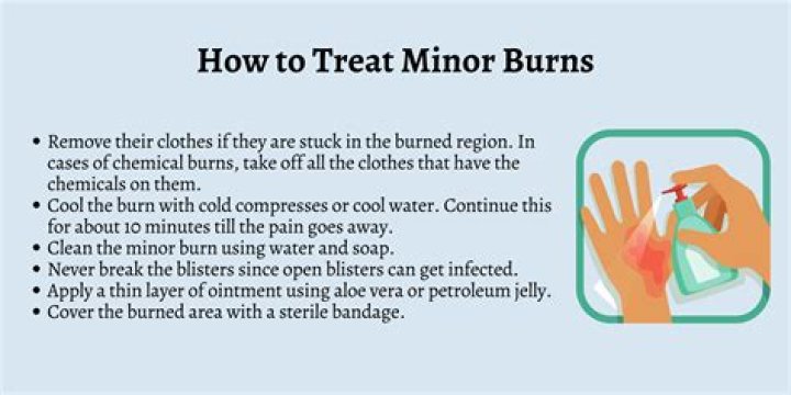 How do you burn a rope?