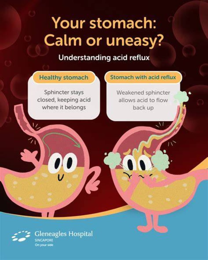 How do you calm stomach acid?