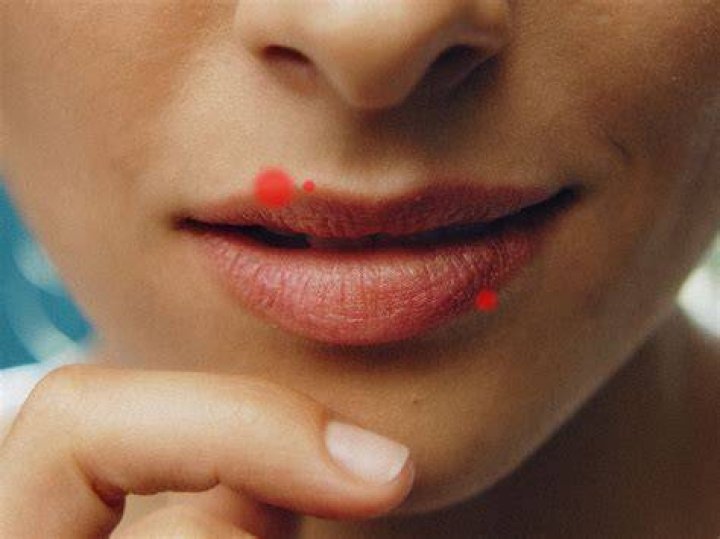 How do you get rid of a pimple on your tongue?