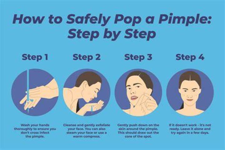 How do you pop a pimple that hurts?