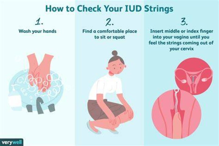 How far up are IUD strings?
