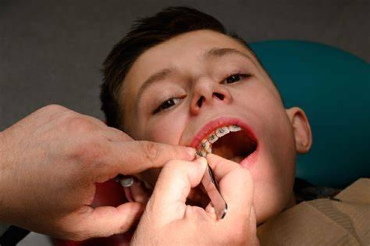 How long does it take for oral surgery to stop hurting?