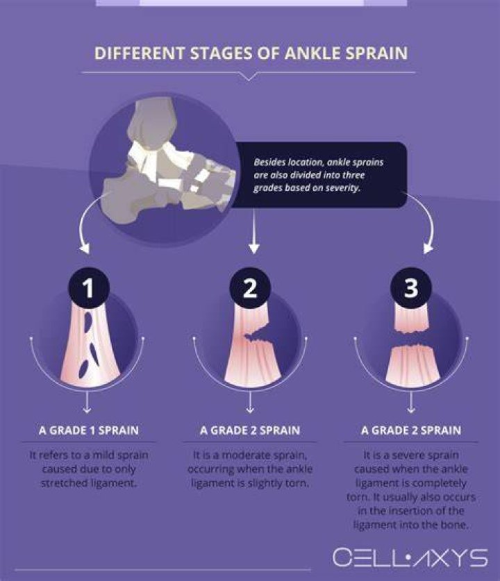 How long should you stay off a sprained ankle?