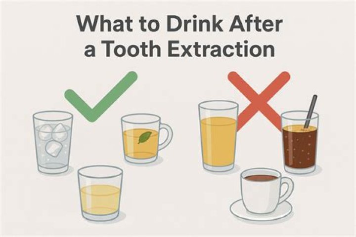 【How-to】Can i drink sprite after tooth extraction