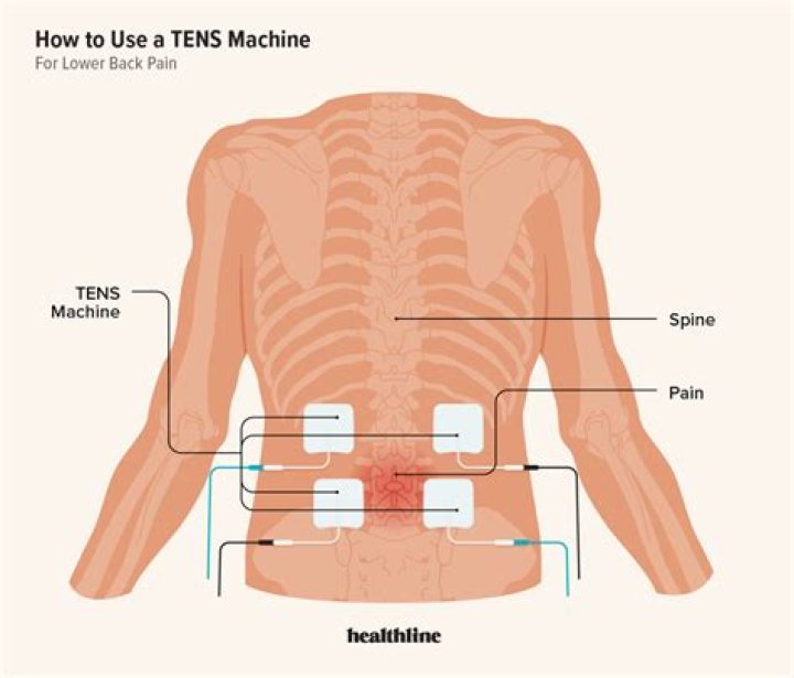 【How-to】Can you use a tens machine on your chest