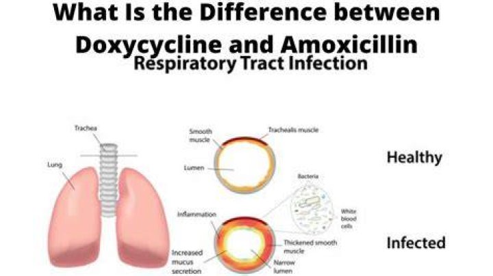 【How-to】How long does doxycycline take to work for chest infection