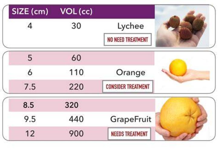 【How-to】How much does a 15 cm ovarian cyst weigh